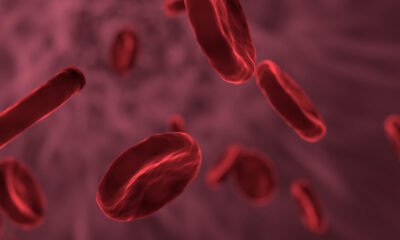 Estudo indica que anticoagulante inibe replicação do vírus da covid
